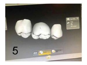 נפלאות ה- CAD CAM